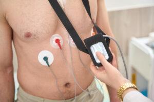 Jak działa badanie Holter EKG